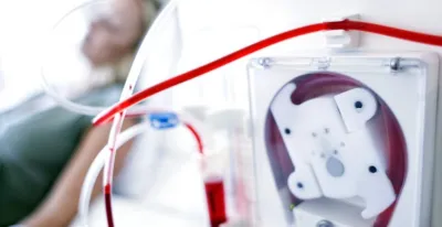 هل ستتوقف عمليات تصفية الدم (غسيل الكلي) في تونس بداية من 11 يناير؟