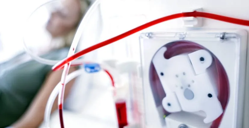 هل ستتوقف عمليات تصفية الدم (غسيل الكلي) في تونس بداية من 11 يناير؟