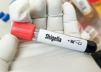 تونس تسجل أول وفاة بجرثومة شيغيلا… هكذا تحدث الإصابة وهكذا تكون الوقاية