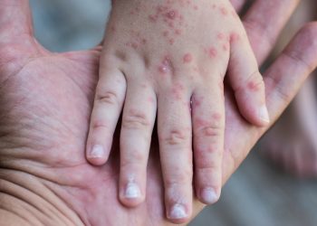 المصدر: داما بوست