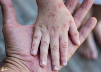 المصدر: وكالة الغد برس